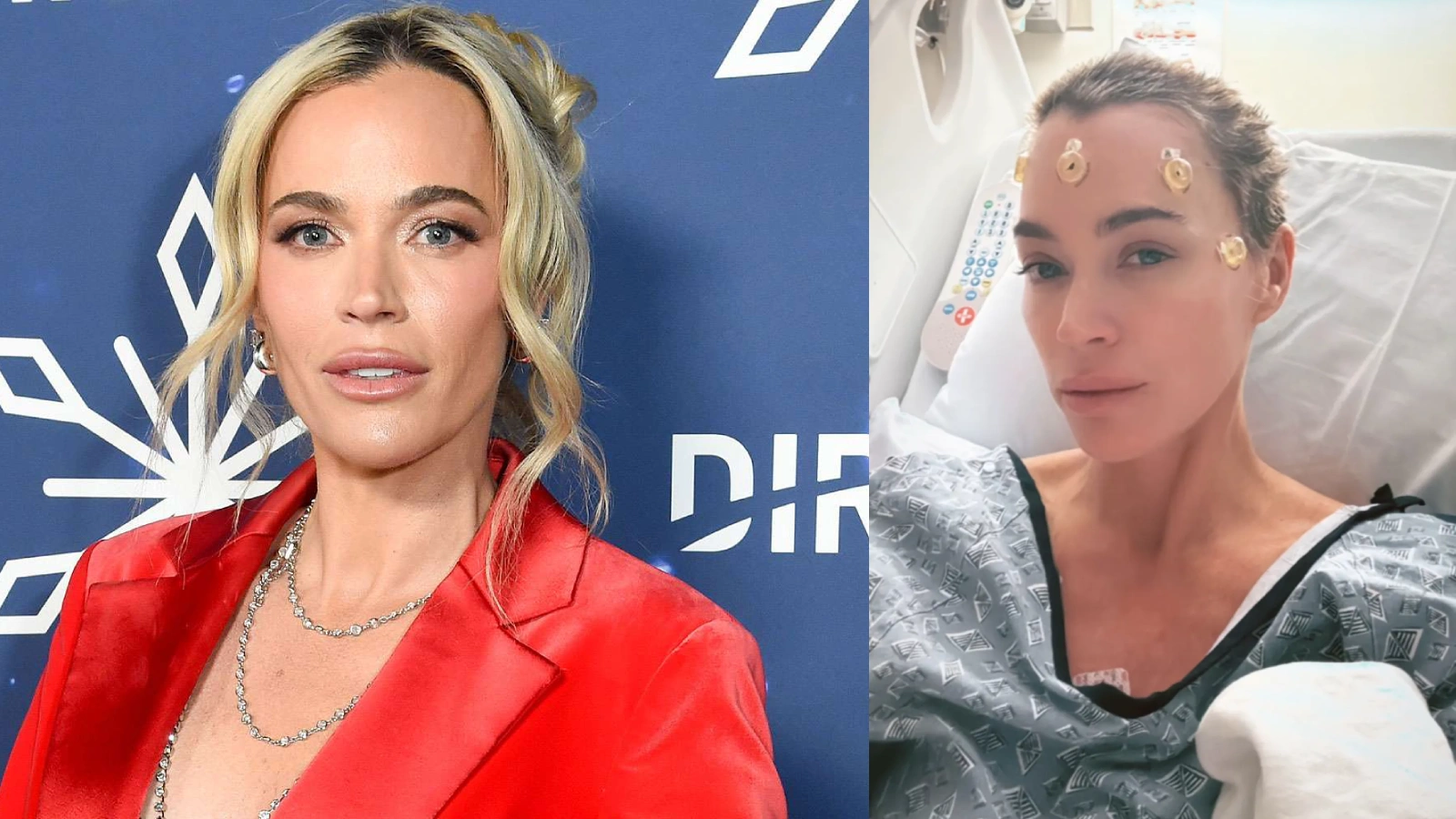 Teddi Mellencamp Cancer Journey