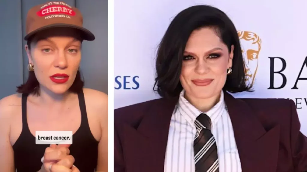 Jessie J’s Brave Battle: Facing Early Breast Cancer with Strength & Positivity 2 Jessie J Breast Cancer Diagnosis