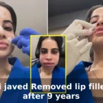 urfi javed removed lip fillers after 9 years