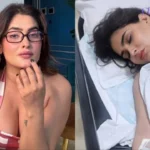 Actress Karishma seriously injured